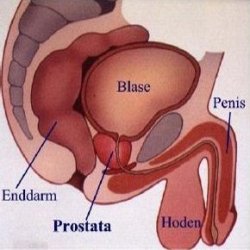 Prostata